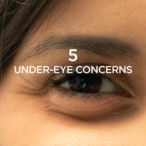 5 Under-Eye Concerns