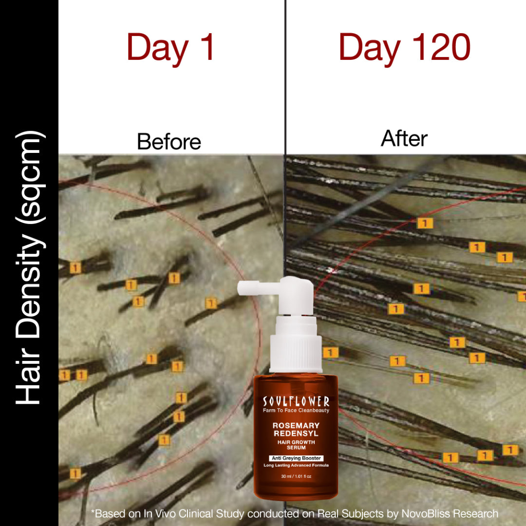 Rosemary Redensyl Hair Growth Serum