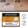 Sandalwood Soap Proven to Lighten & Brighten Skin